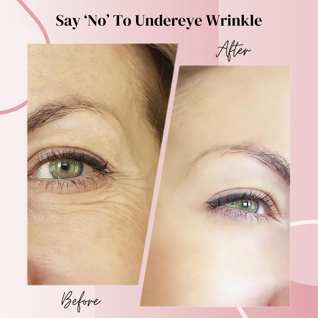 LaviamLift™: The Ultimate Face Lifting Device