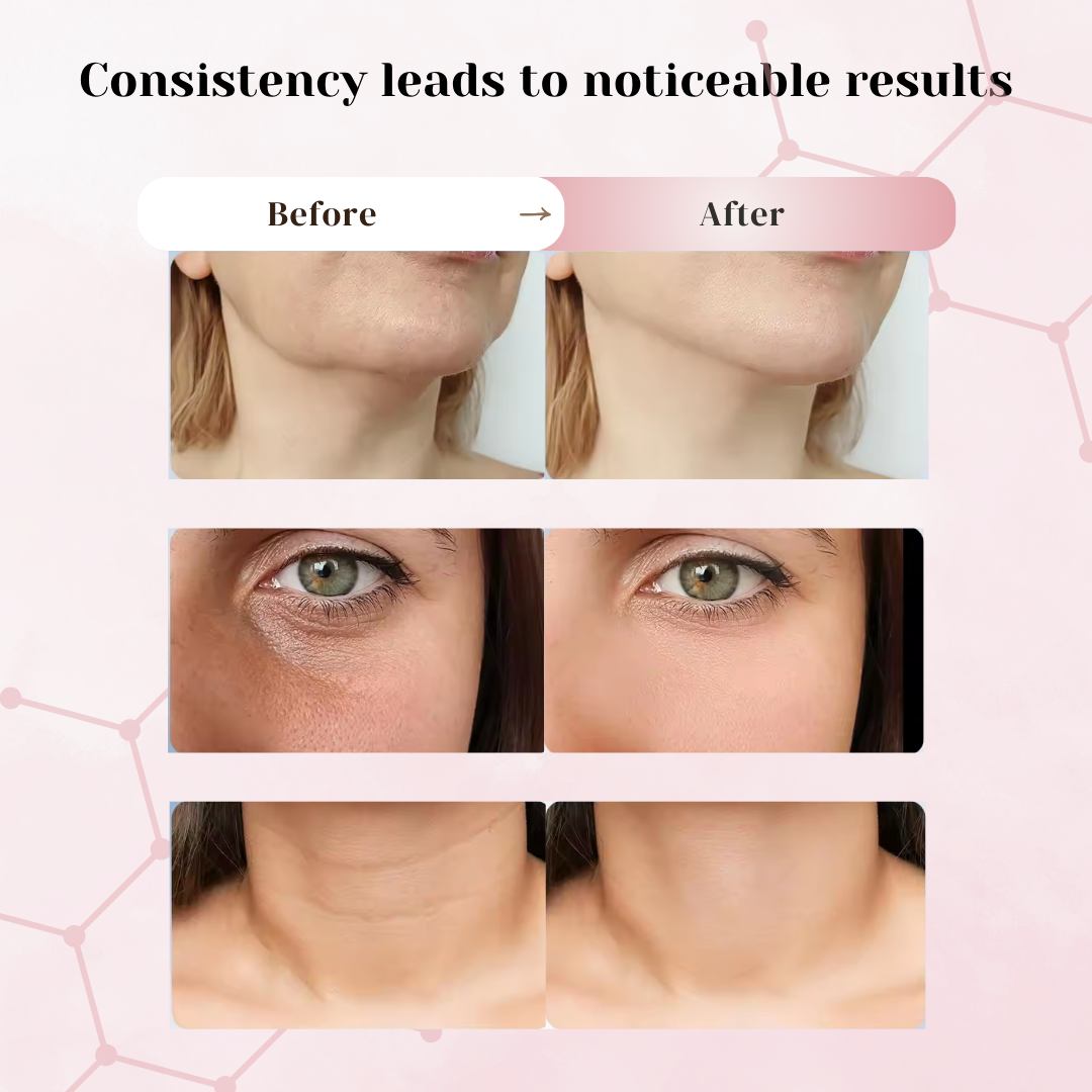 LaviamLift™: The Ultimate Face Lifting Device